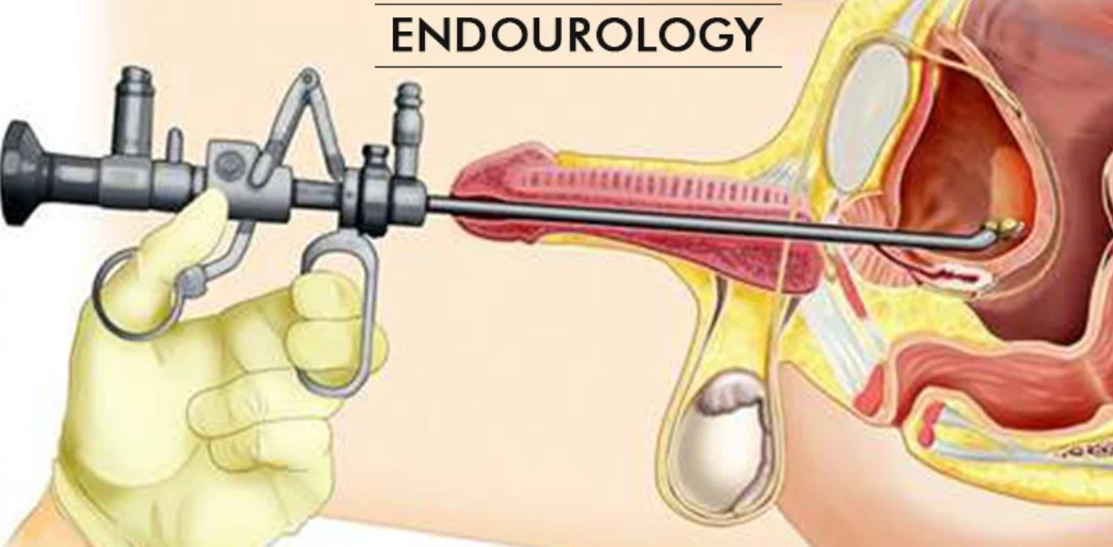 Endourology